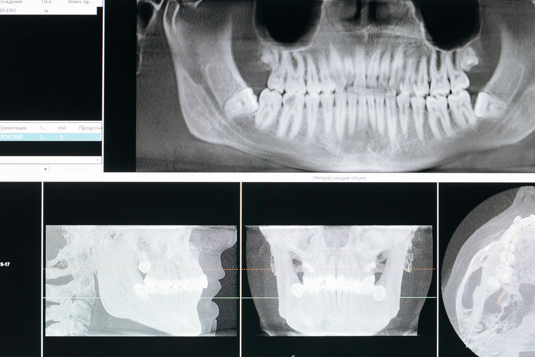 Study: Humans May Be Able To Grow New Teeth Within 6 Years (Clinical Trials Starting)