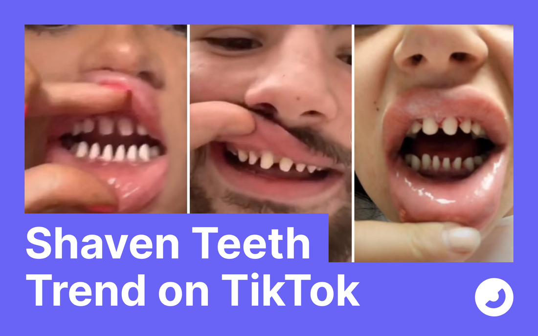 tiktok trend veneers shaved teeth